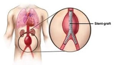 Aort Damarı Özellikleri ve Faydaları Nelerdir?